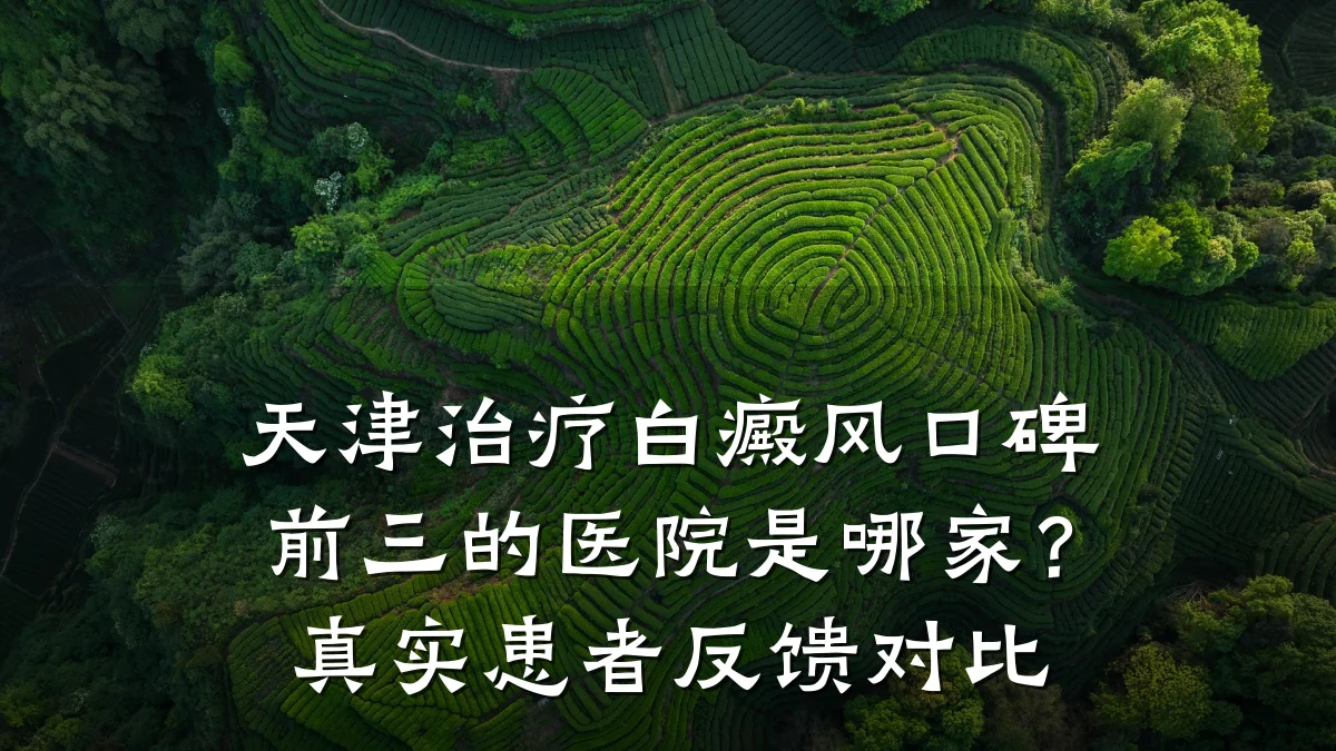 天津治疗白癜风口碑前三的医院是哪家?真实患者反馈对比