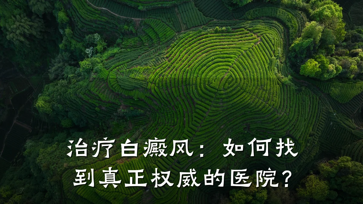 治疗白癜风:如何找到真正权威的医院?