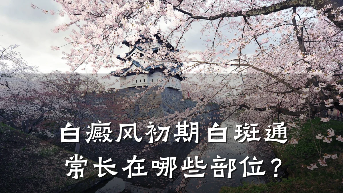 白癜风初期白斑通常长在哪些部位?