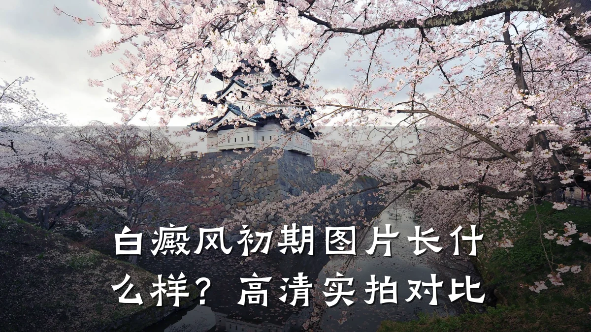 白癜风初期图片长什么样?高清实拍对比