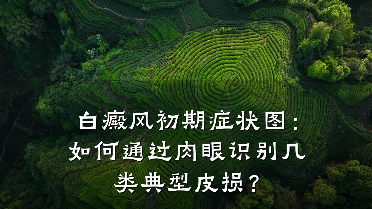 白癜风初期症状图：如何通过肉眼识别几类典型皮损？