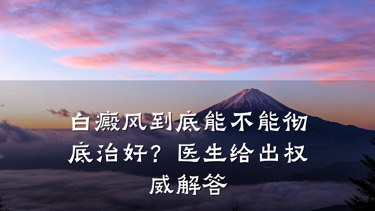 白癜风到底能不能彻底治好?医生给出权威解答