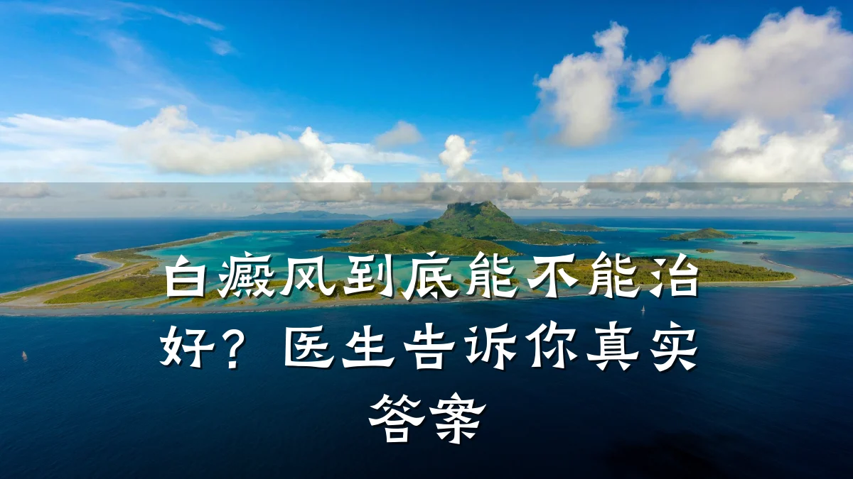 白癜风到底能不能治好?医生告诉你真实答案