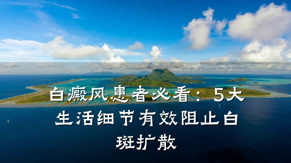 白癜风患者必看:5大生活细节有效阻止白斑扩散