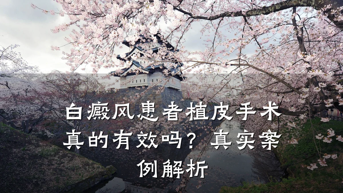 白癜风患者植皮手术真的有效吗?真实案例解析