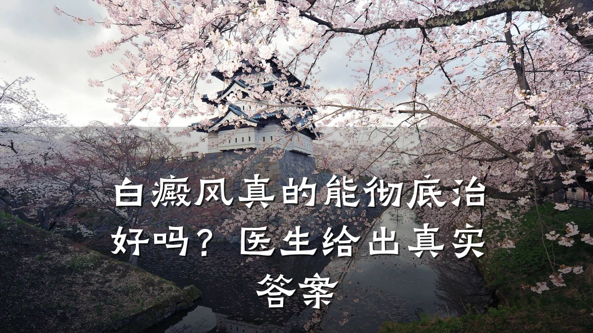 白癜风真的能彻底治好吗?医生给出真实答案