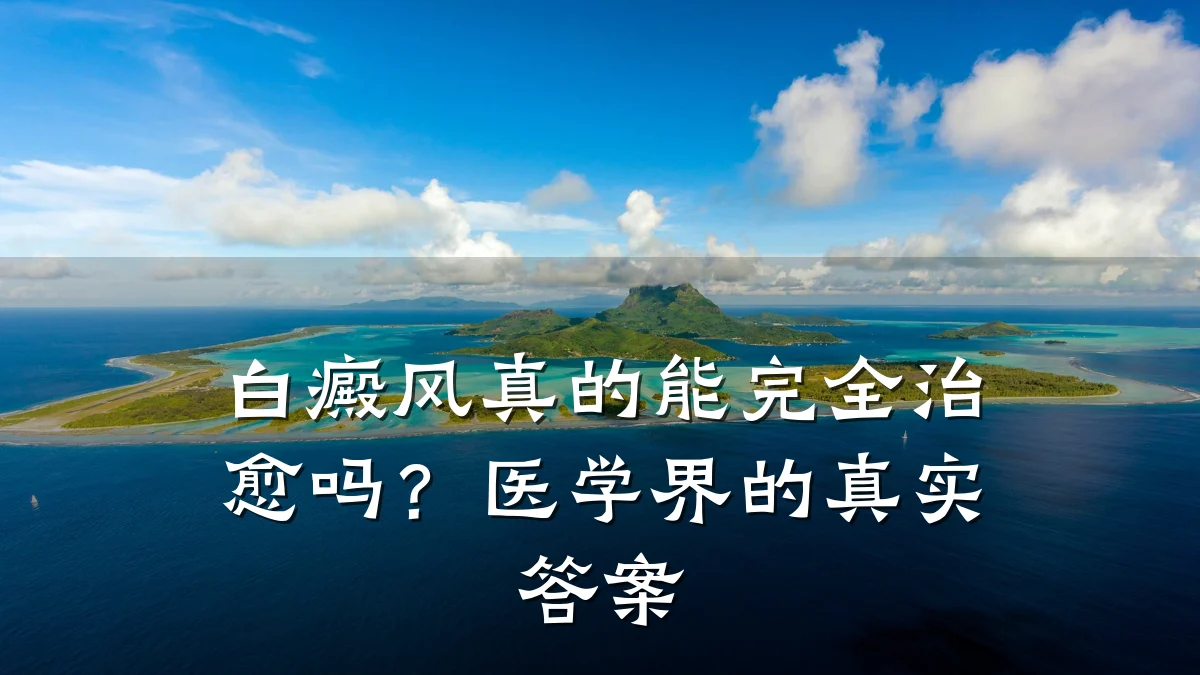 白癜风真的能完全治愈吗?医学界的真实答案