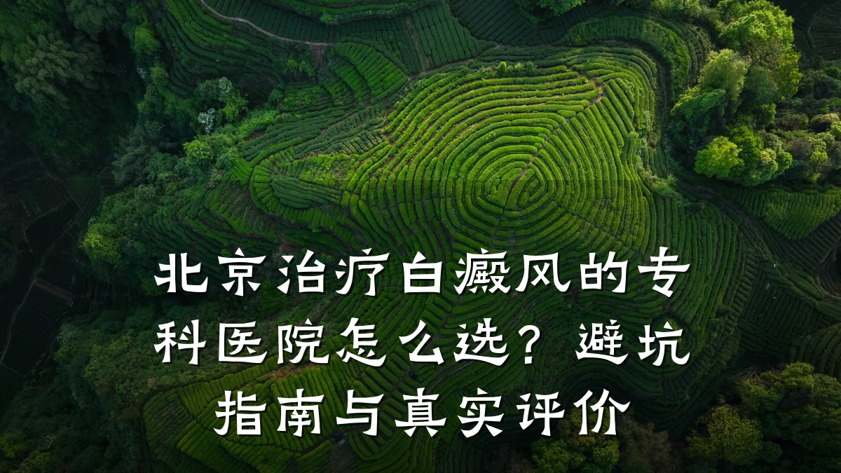 北京治疗白癜风的专科医院怎么选?避坑指南与真实评价