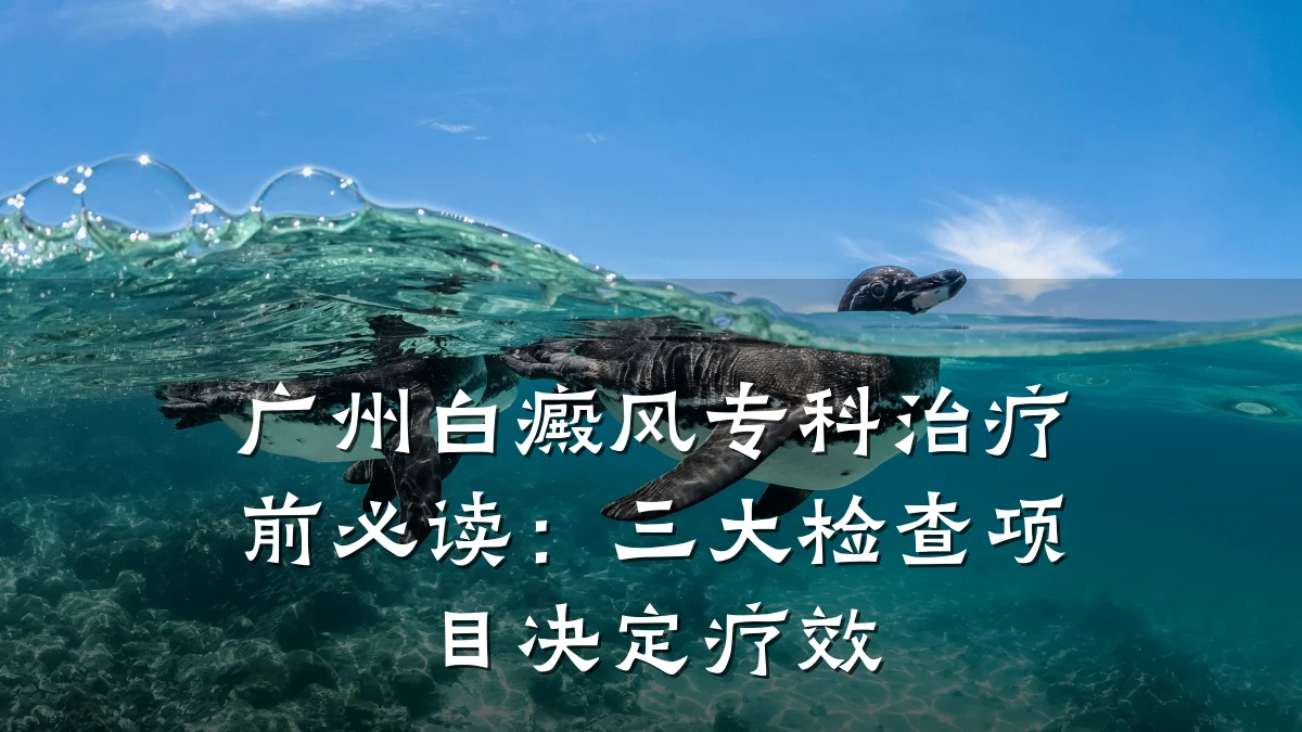 广州白癜风专科治疗前必读：三大检查项目决定疗效
