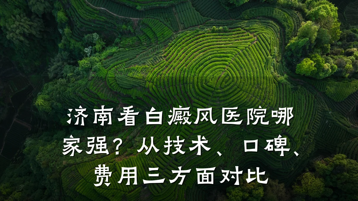济南看白癜风医院哪家强?从技术、口碑、费用三方面对比