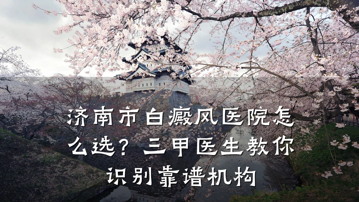 济南市白癜风医院怎么选?三甲医生教你识别靠谱机构