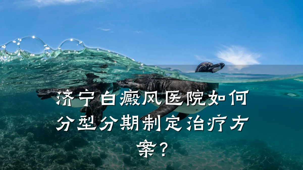 济宁白癜风医院如何分型分期制定治疗方案?