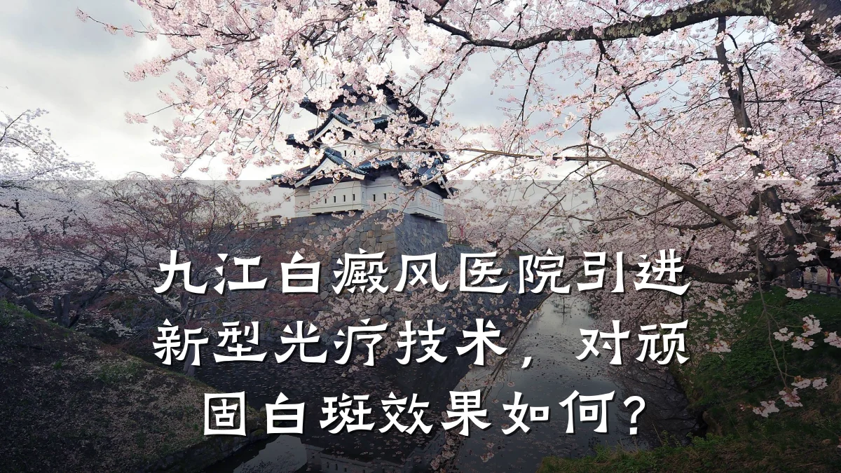 九江白癜风医院引进新型光疗技术,对顽固白斑效果如何?
