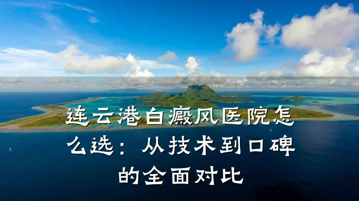 连云港白癜风医院怎么选:从技术到口碑的全面对比