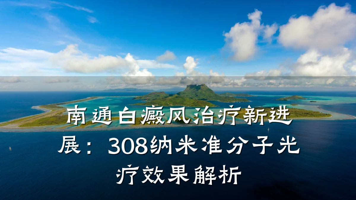 南通白癜风治疗新进展：308纳米准分子光疗效果解析