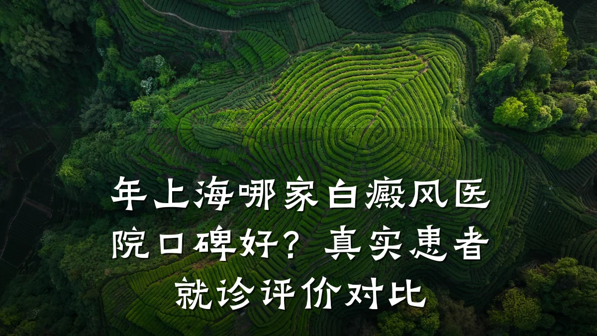 年上海哪家白癜风医院口碑好?真实患者就诊评价对比