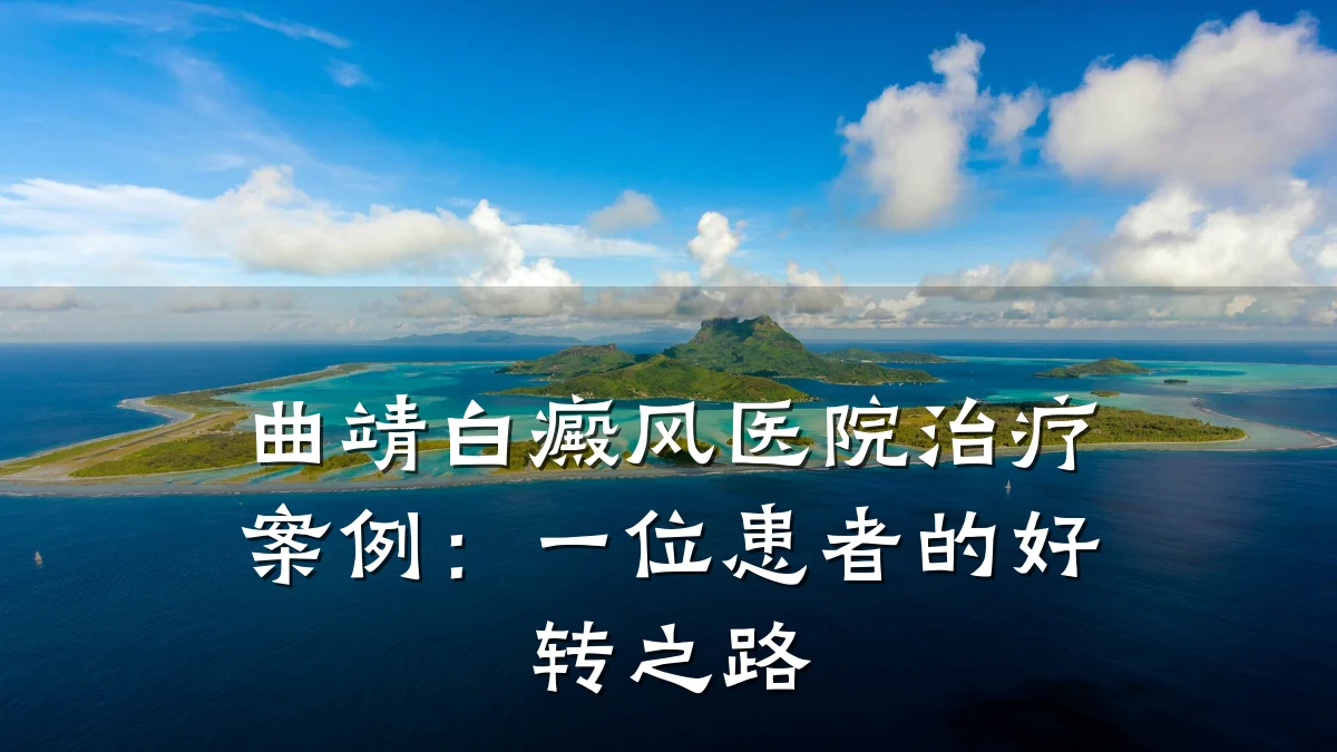 曲靖白癜风医院治疗案例:一位患者的好转之路