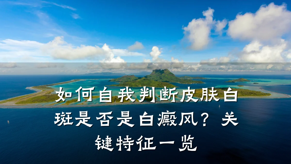 如何自我判断皮肤白斑是否是白癜风?关键特征一览