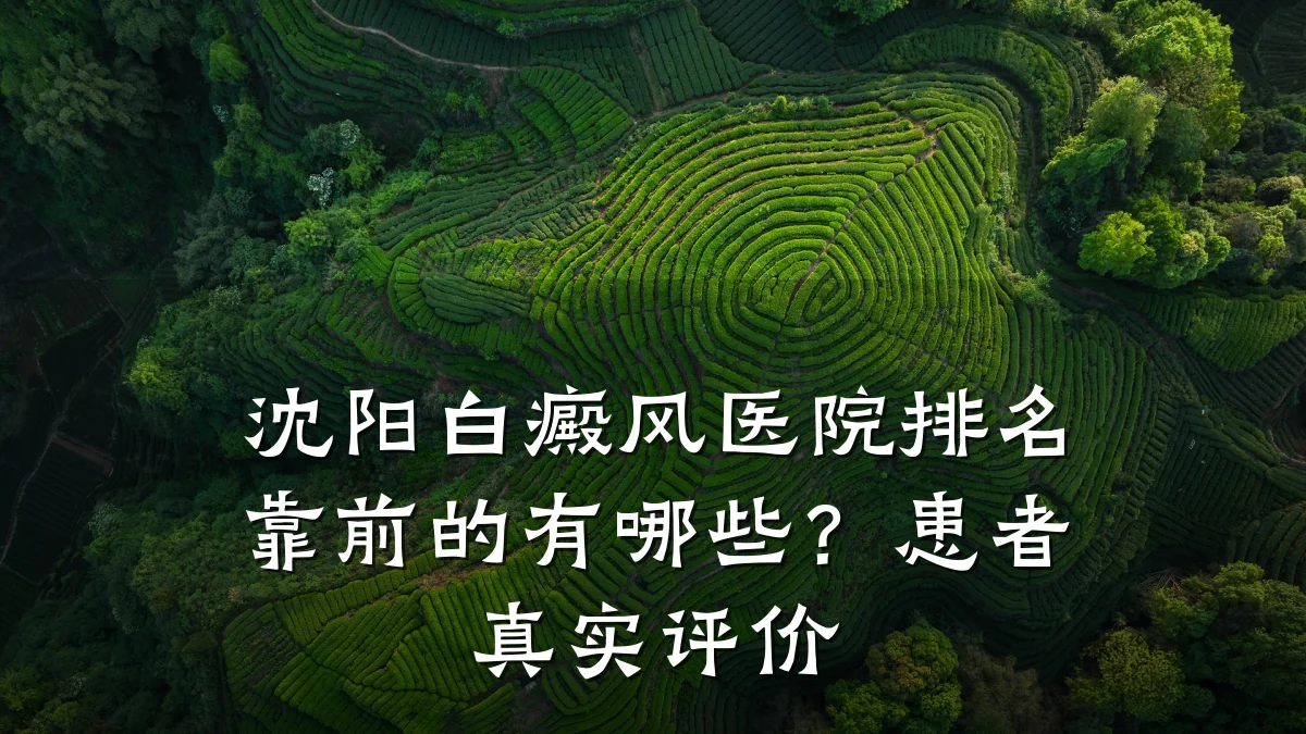沈阳白癜风医院排名靠前的有哪些?患者真实评价