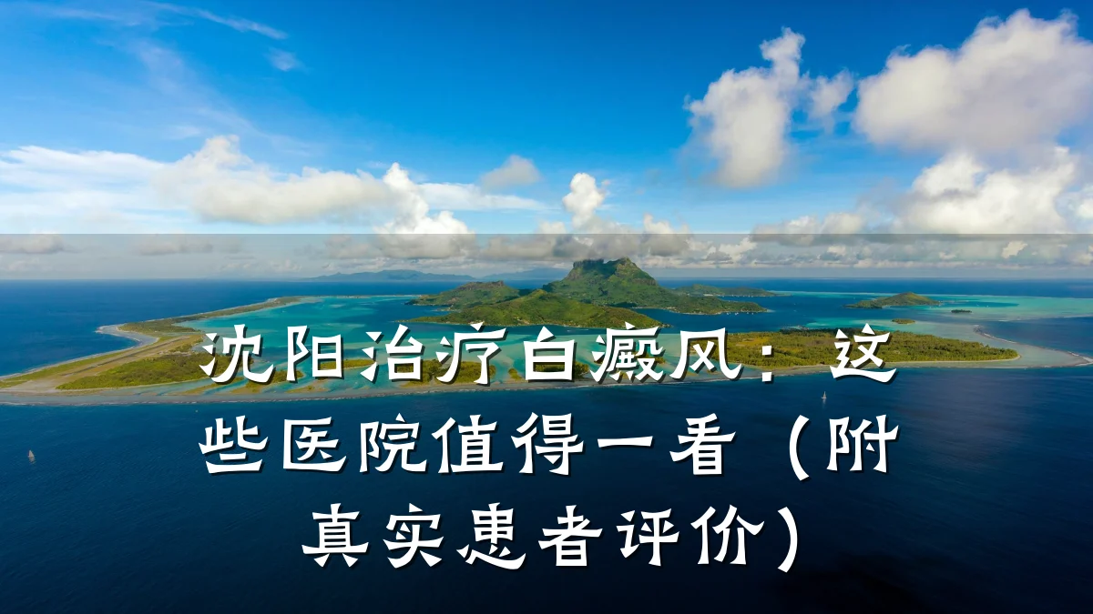 沈阳治疗白癜风:这些医院值得一看(附真实患者评价)