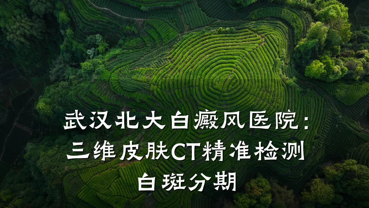 武汉北大白癜风医院:三维皮肤CT精准检测白斑分期