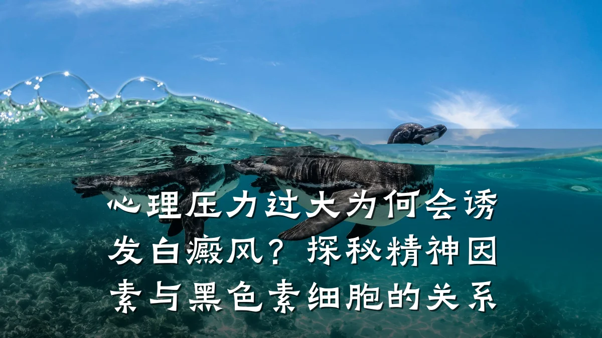 心理压力过大为何会诱发白癜风?探秘精神因素与黑色素细胞的关系