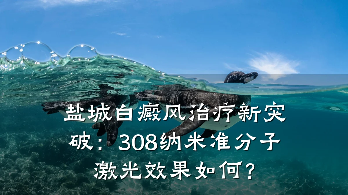 盐城白癜风治疗新突破:308纳米准分子激光效果如何?
