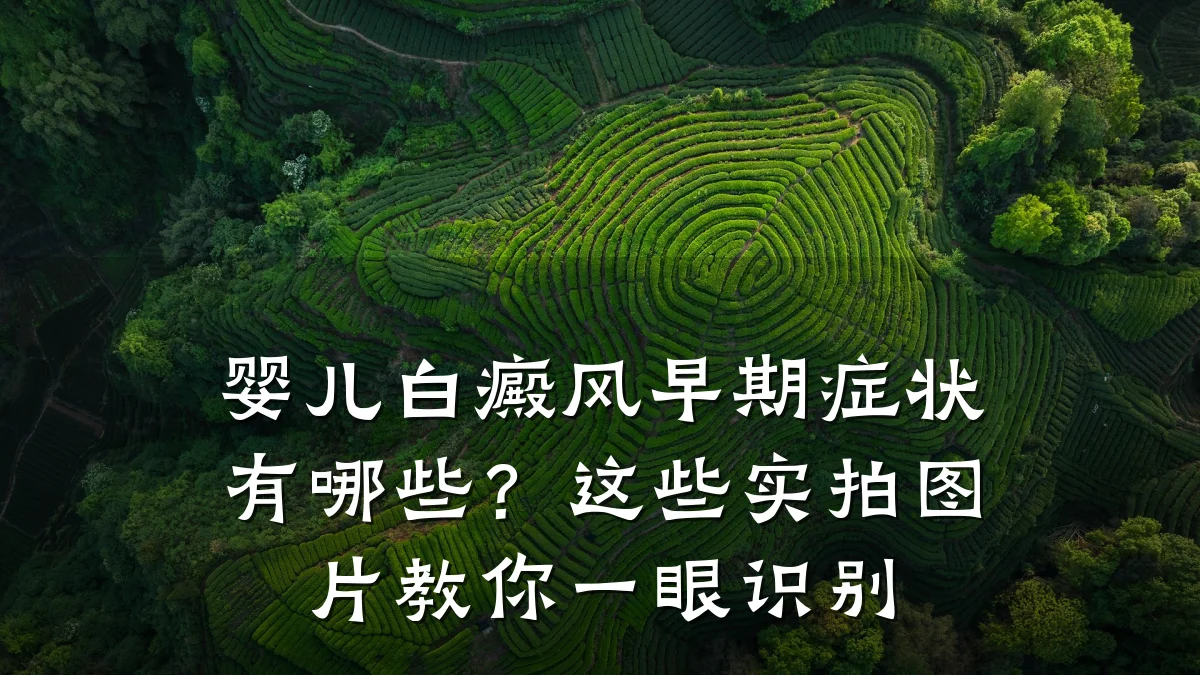 婴儿白癜风早期症状有哪些？这些实拍图片教你一眼识别
