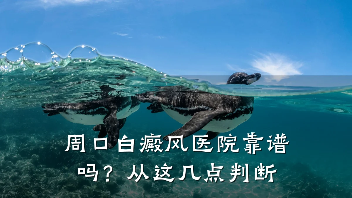 周口白癜风医院靠谱吗?从这几点判断