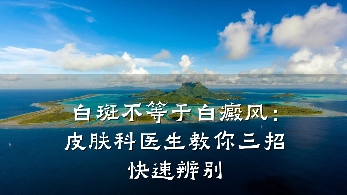 白斑不等于白癜风:皮肤科医生教你三招快速辨别