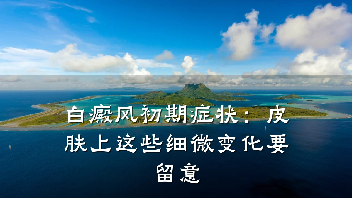 白癜风初期症状:皮肤上这些细微变化要留意