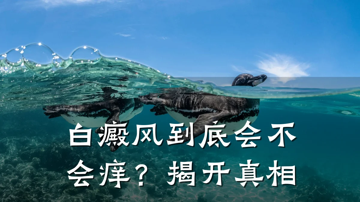 白癜风到底会不会痒?揭开真相