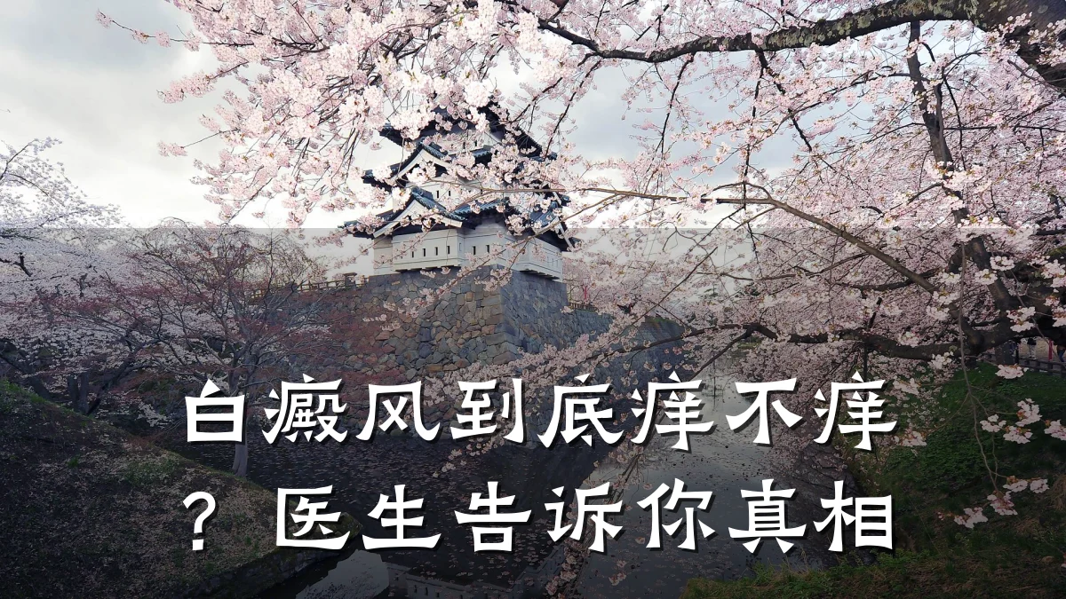 白癜风到底痒不痒?医生告诉你真相