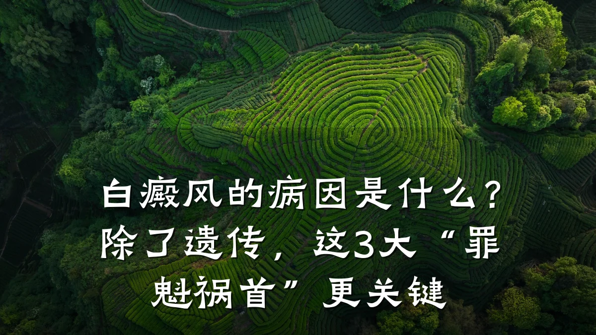 白癜风的病因是什么?除了遗传,这3大“罪魁祸首”更关键