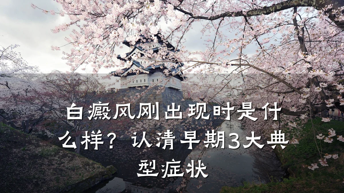 白癜风刚出现时是什么样？认清早期3大典型症状