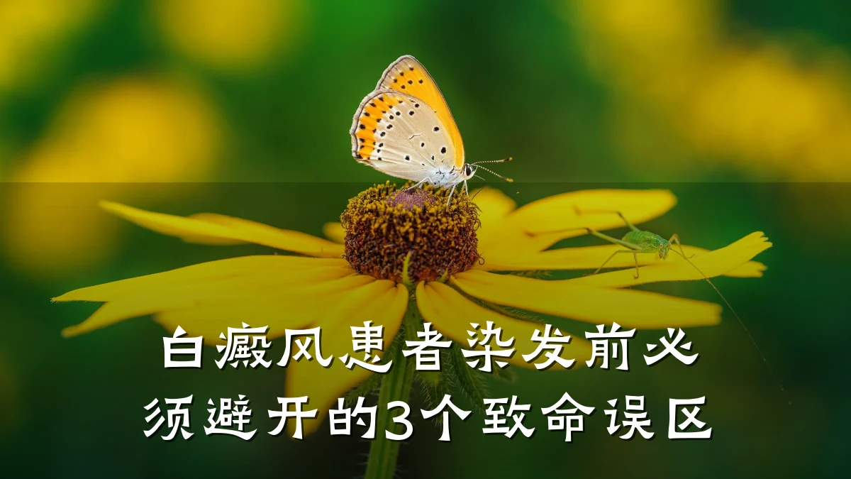 白癜风患者染发前必须避开的3个致命误区