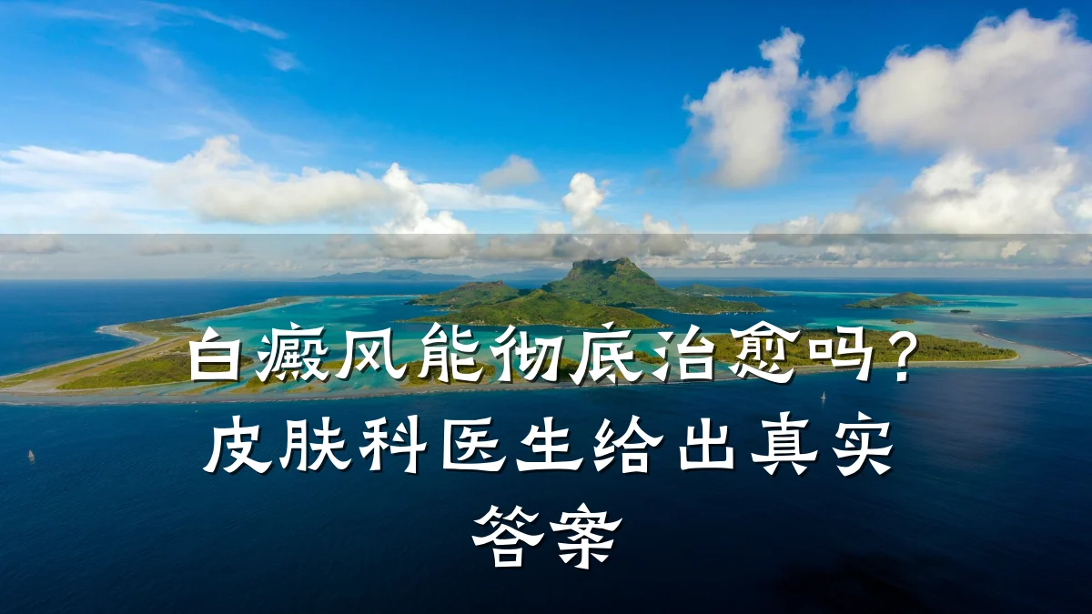白癜风能彻底治愈吗?皮肤科医生给出真实答案