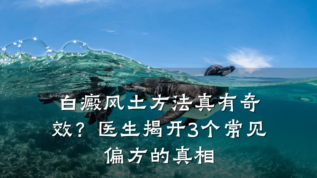 白癜风土方法真有奇效?医生揭开3个常见偏方的真相