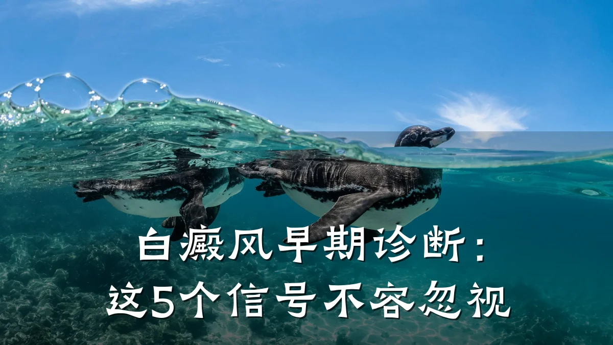 白癜风早期诊断：这5个信号不容忽视