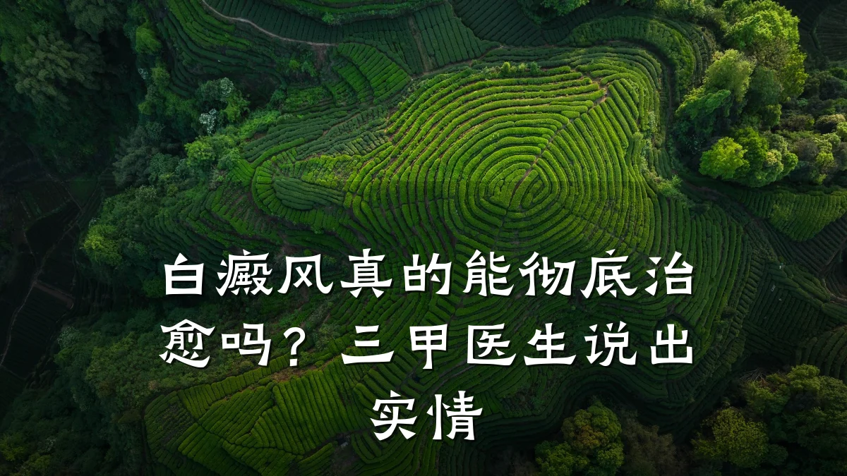 白癜风真的能彻底治愈吗?三甲医生说出实情