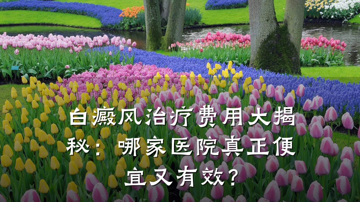 白癜风治疗费用大揭秘：哪家医院真正便宜又有效？