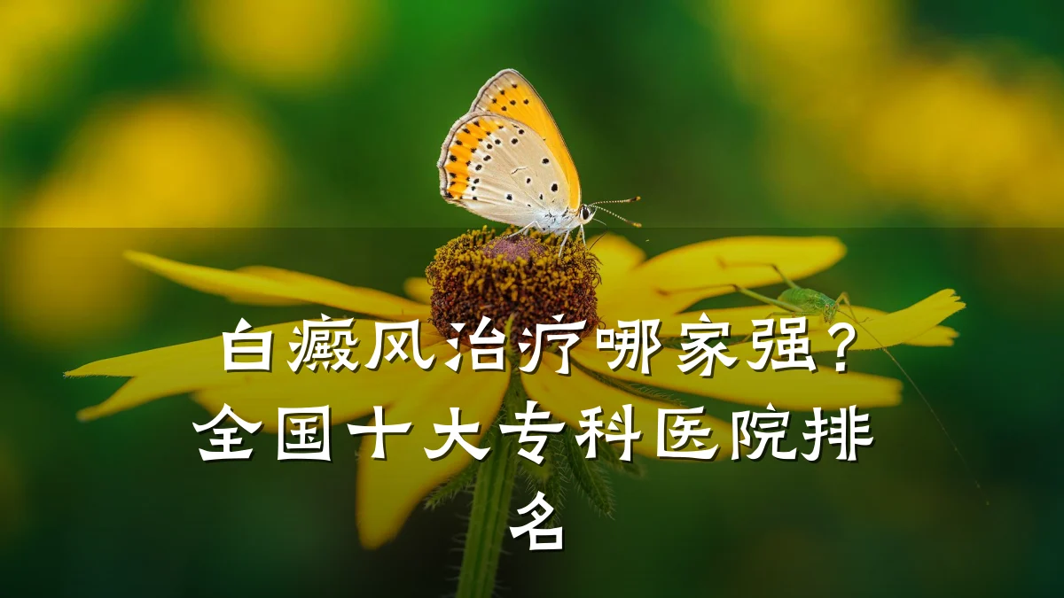 白癜风治疗哪家强?全国十大专科医院排名