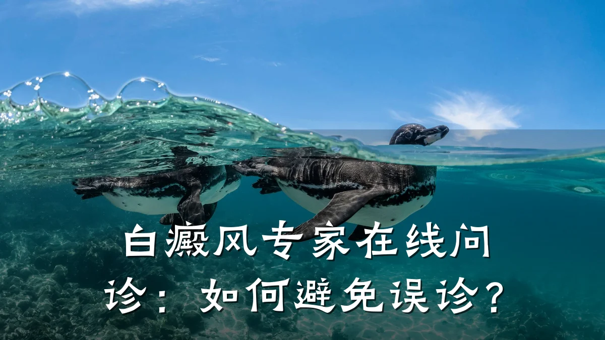 白癜风专家在线问诊:如何避免误诊?
