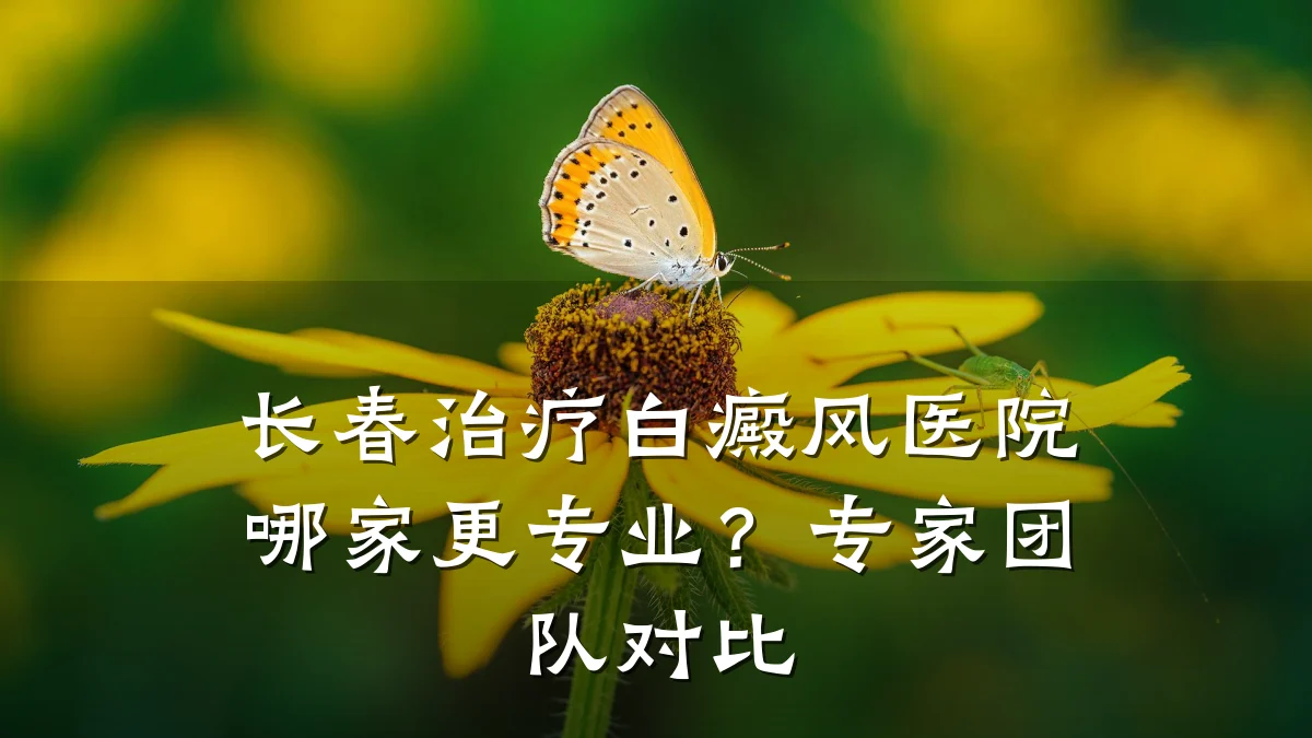 长春治疗白癜风医院哪家更专业？专家团队对比