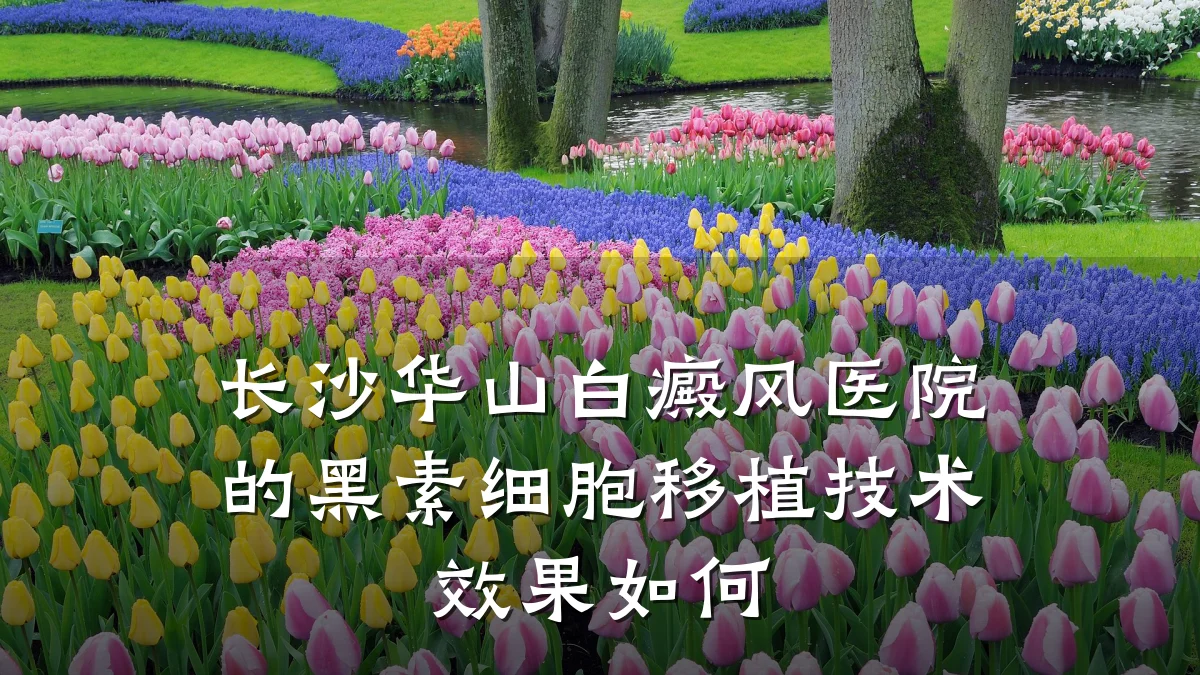 长沙华山白癜风医院的黑素细胞移植技术效果如何