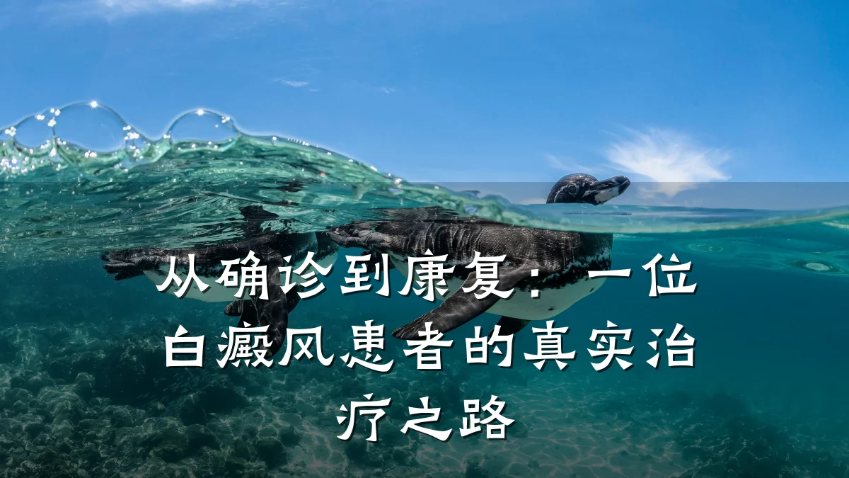 从确诊到康复:一位白癜风患者的真实治疗之路