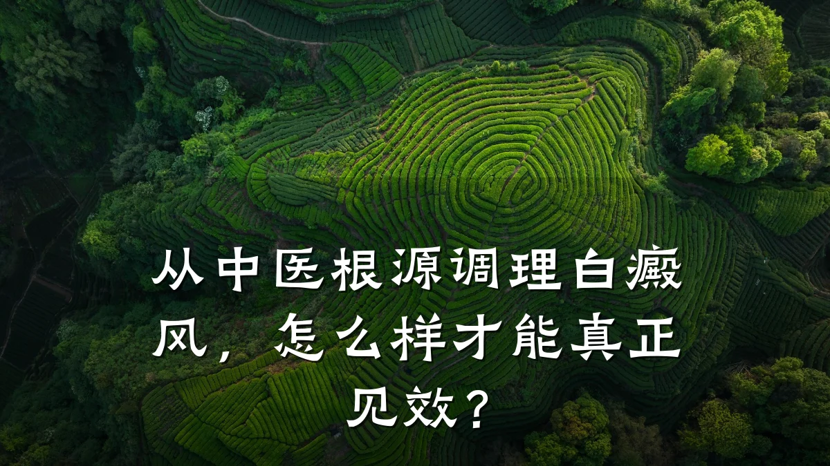 从中医根源调理白癜风,怎么样才能真正见效?