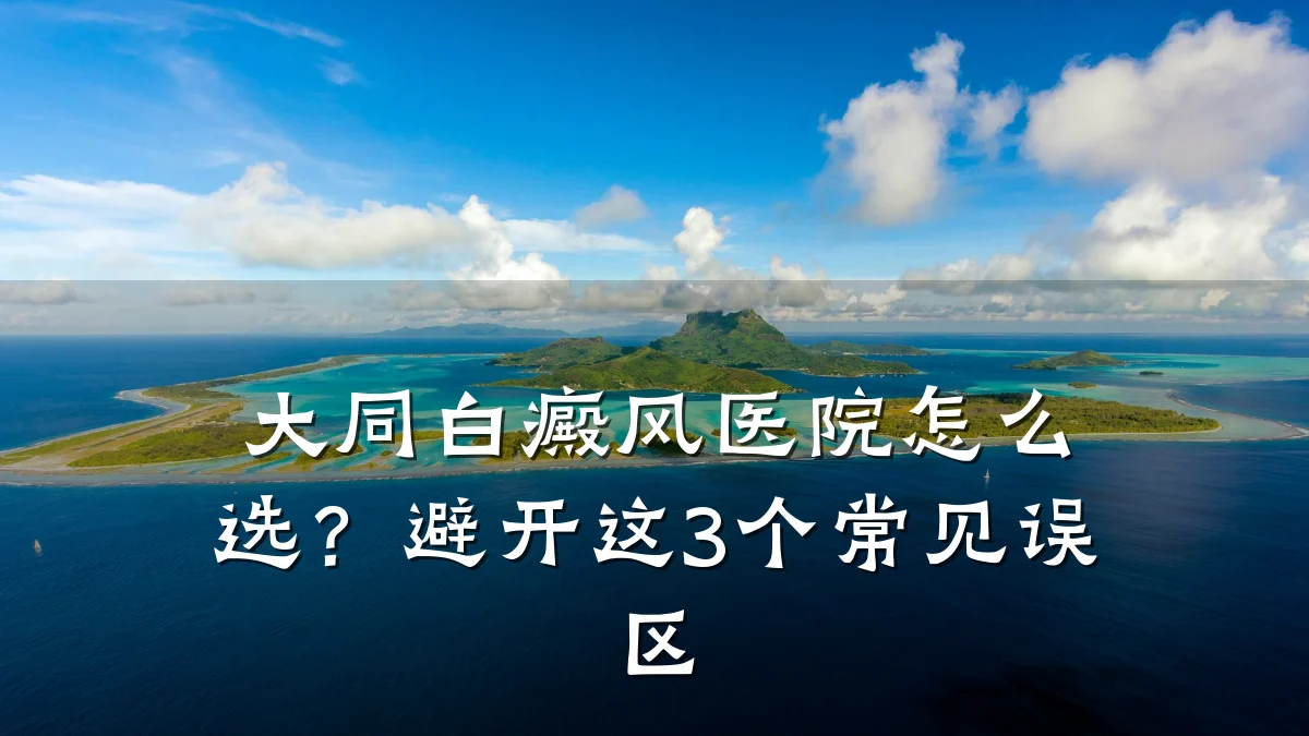 大同白癜风医院怎么选?避开这3个常见误区