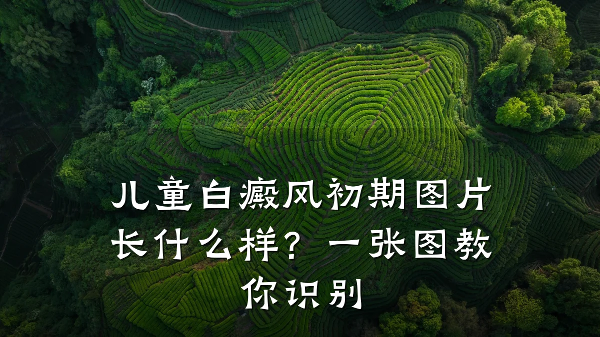 儿童白癜风初期图片长什么样?一张图教你识别