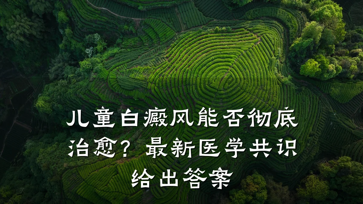 儿童白癜风能否彻底治愈?最新医学共识给出答案